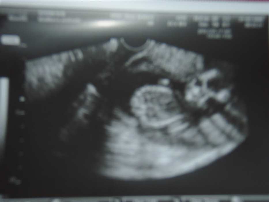 Nezobrazila se V�m fotografie �.16