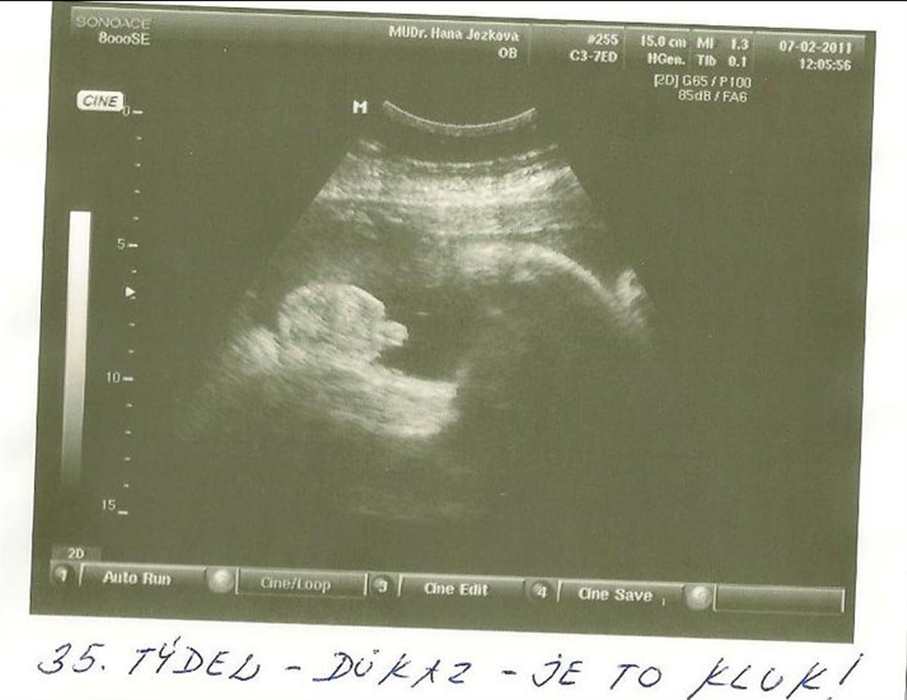 Nezobrazila se V�m fotografie �.13