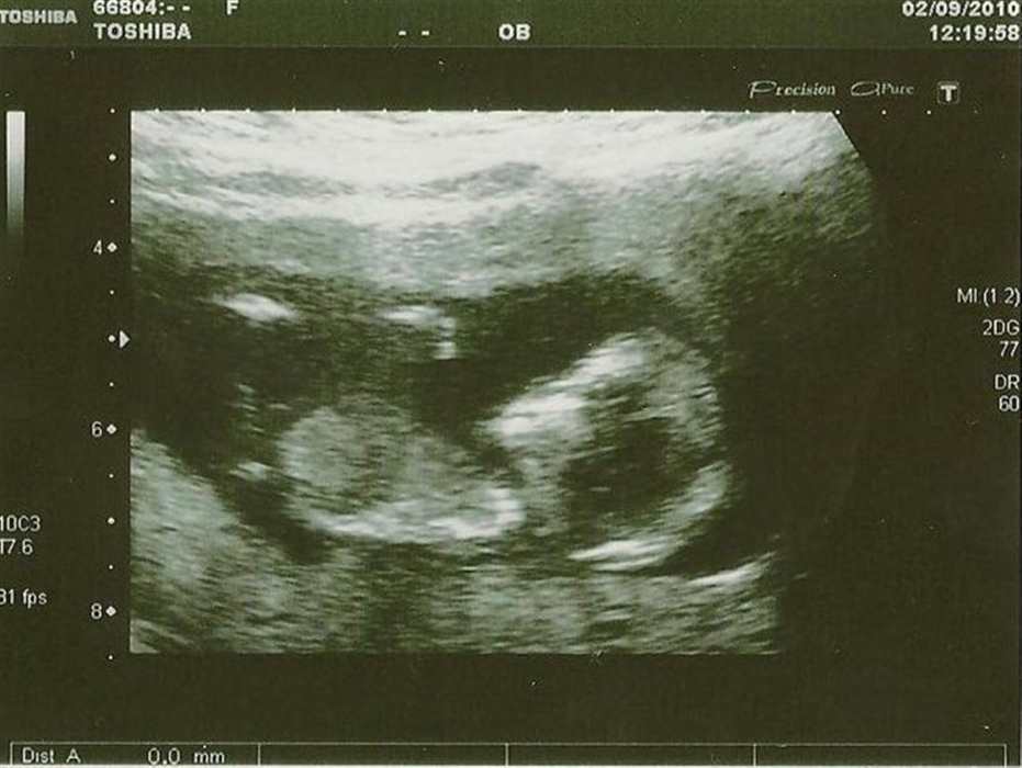 Nezobrazila se V�m fotografie �.3