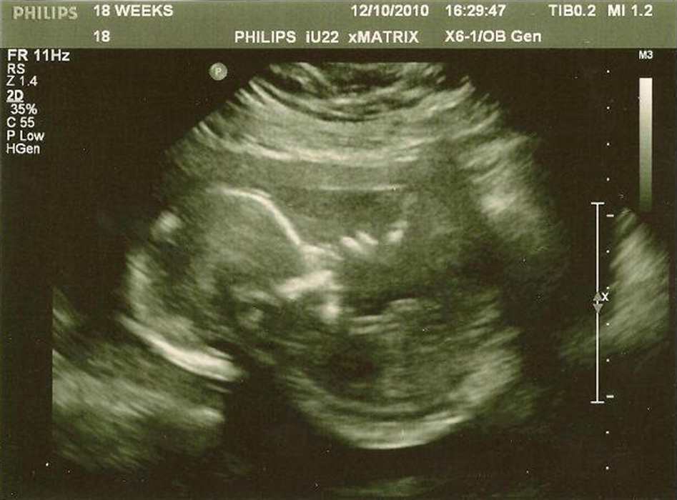 Nezobrazila se V�m fotografie �.7